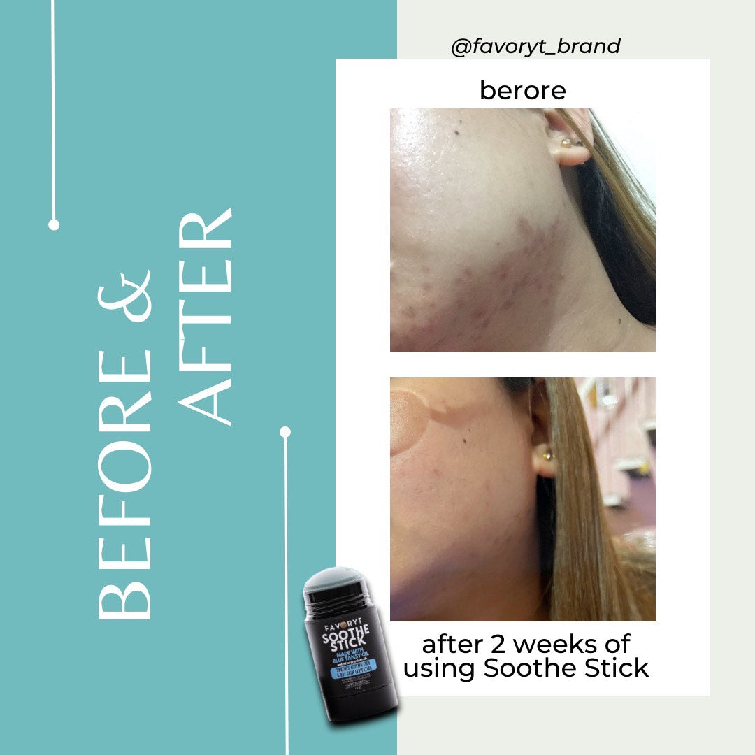 Soothe Stick - FAVORYT BRAND