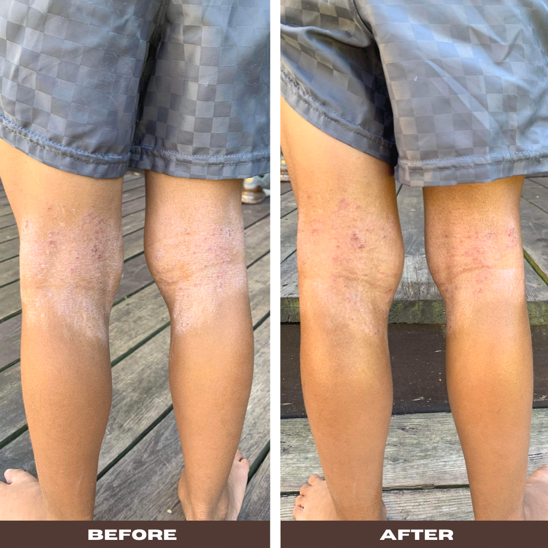 Soothe Stick - FAVORYT BRAND