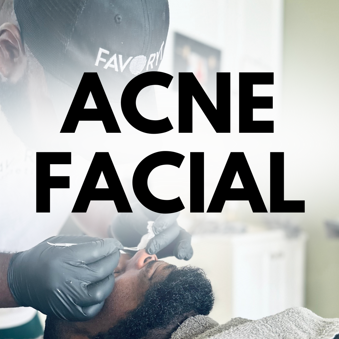 Acne Facial