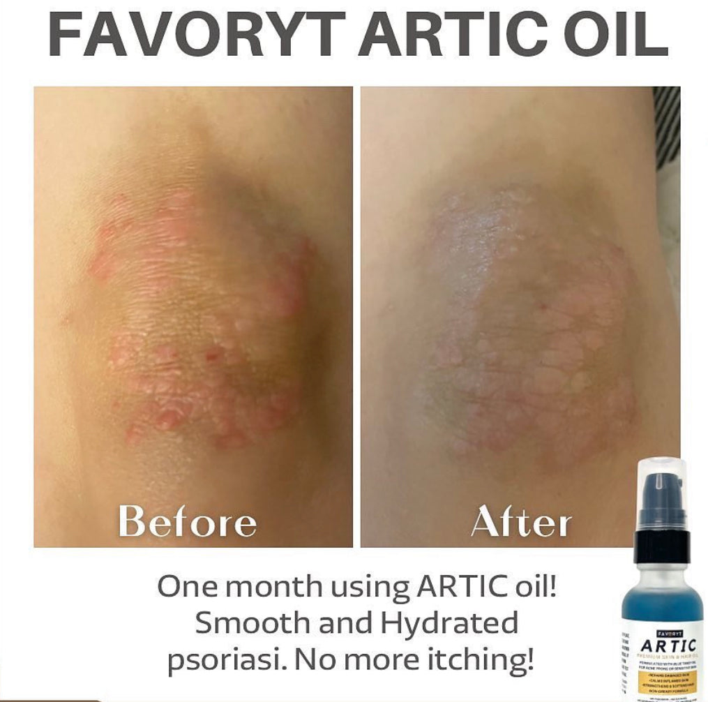 ARTIC Premium Skin & Hair Oil - FAVORYT BRAND